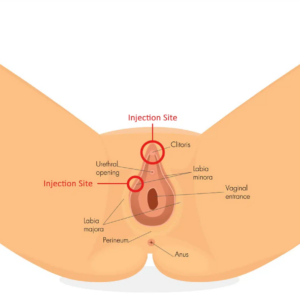 FEMALE SEXUAL WELLNESS PRP SHOT