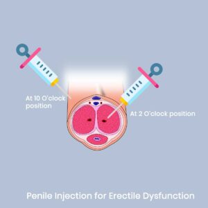 MALE SEXUAL WELLNESS PRP SHOT